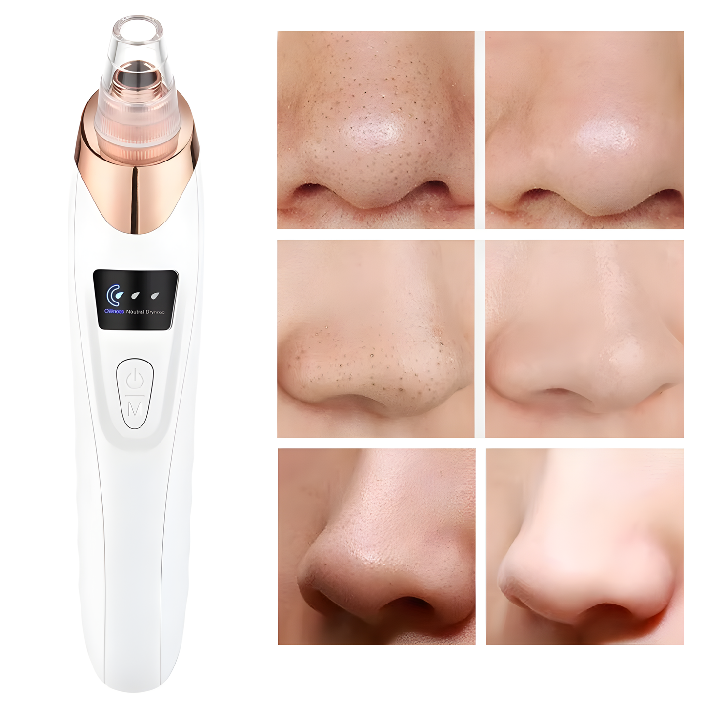 Removedor de puntos negros